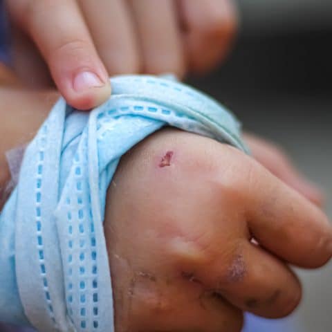 Asistencia Legal Para Accidentes Por Mordeduras De Perros En Victorville