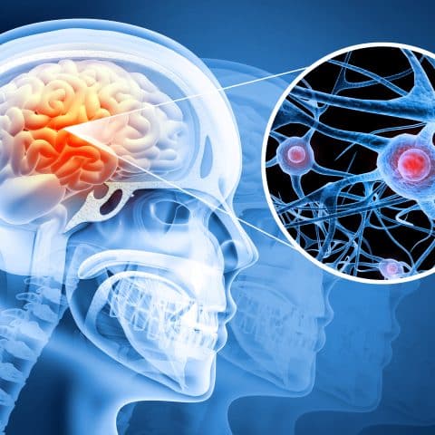 Abogados Especializados En Lesiones Cerebrales Traumáticas De Merced