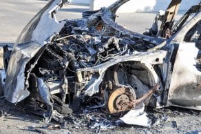 desfiguracion-despues-de-un-accidente